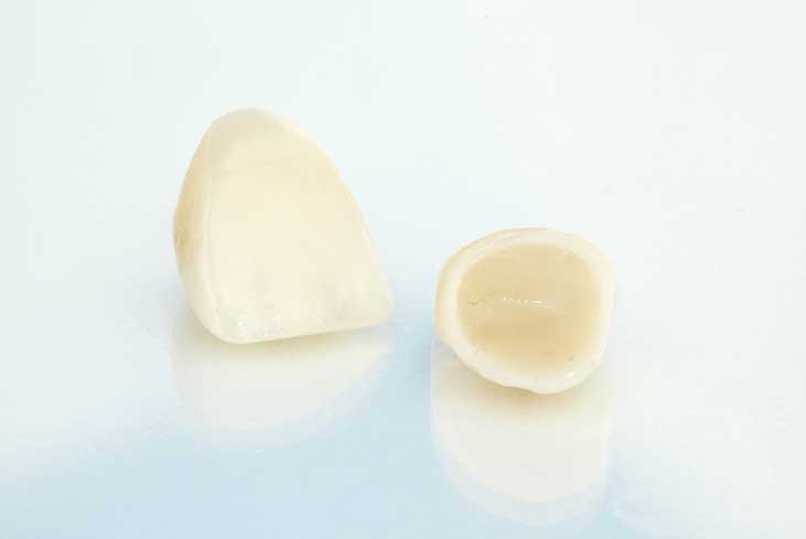 Ceramic-Crowns Ceramic-crowns