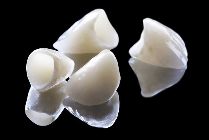 Zirconia-Crowns Zirconia-crowns