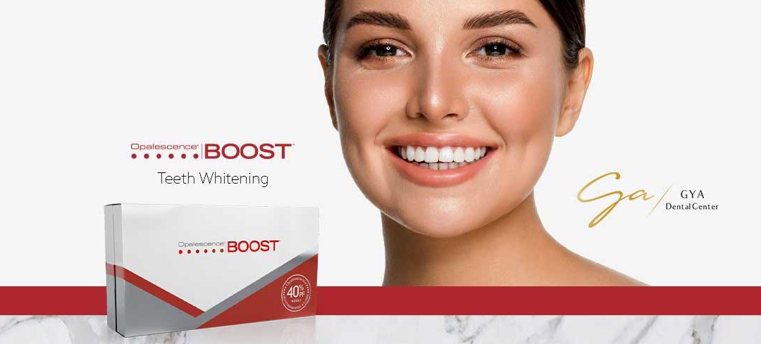 Why Opalescence Teeth Whitening Boost is unique