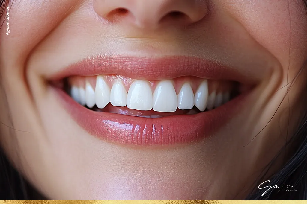 تنظيف الأسنان إجراءات طب الأسنان التجميلية
