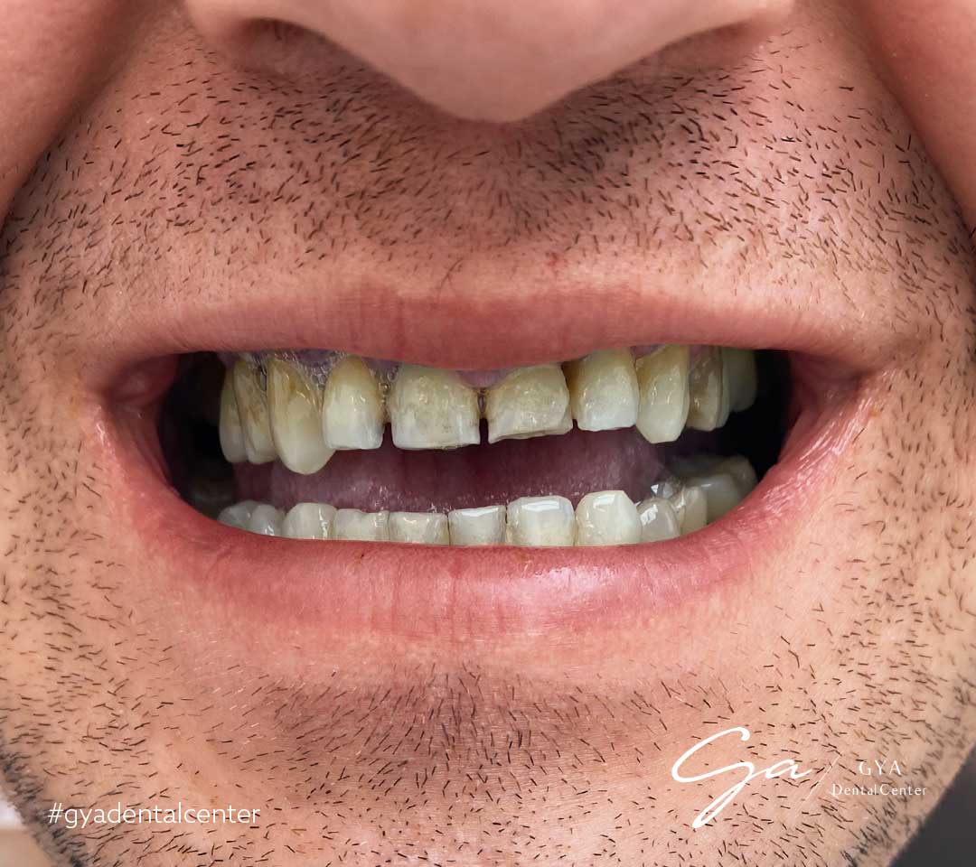 | GYA Dental Center | April, 2025 | GYA Dental Center | April, 2025