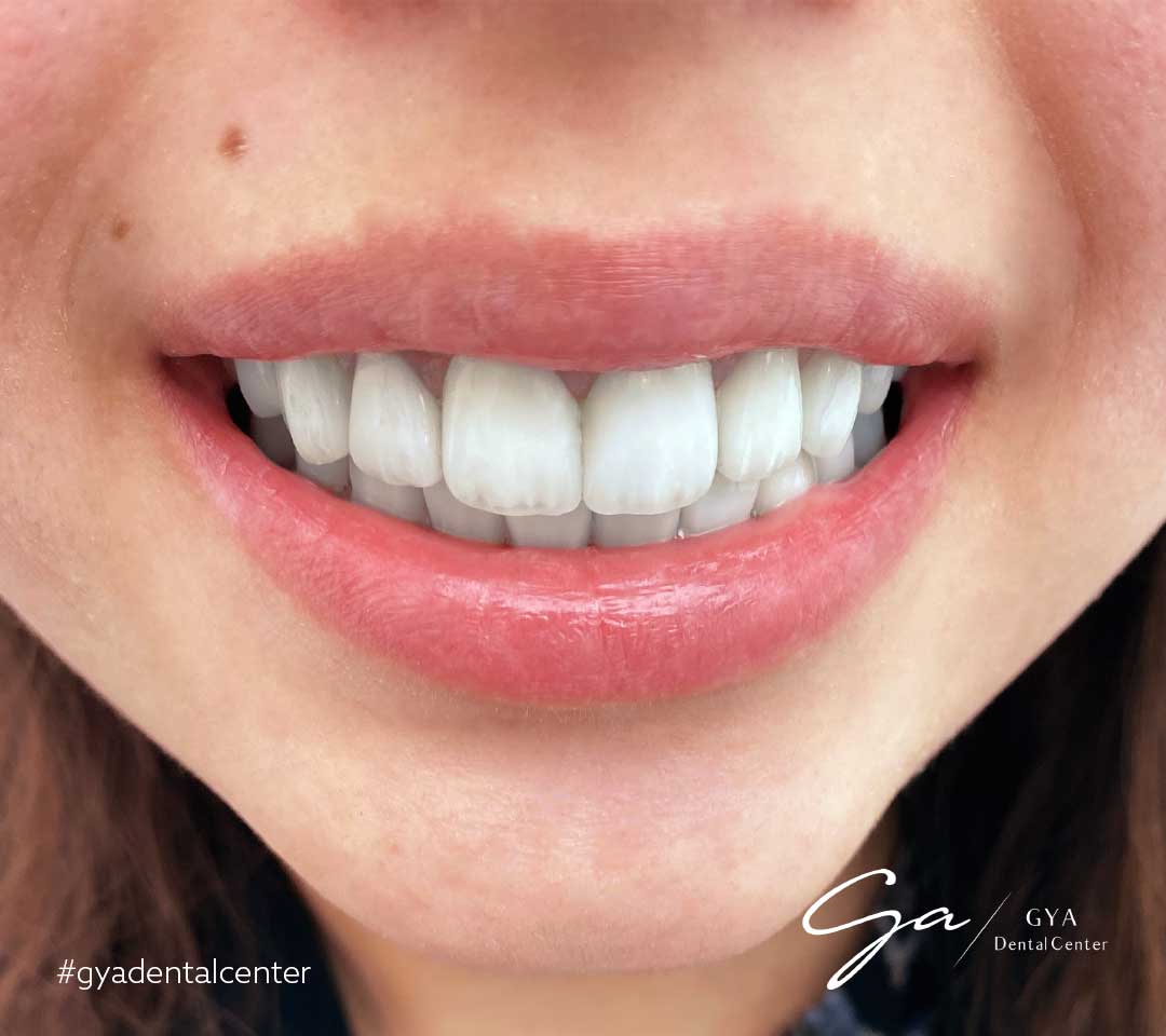 | GYA Dental Center | April, 2025 | GYA Dental Center | April, 2025