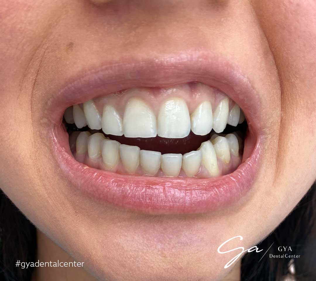 | GYA Dental Center | April, 2025 | GYA Dental Center | April, 2025
